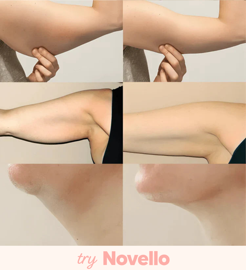 Lymphology – The #1 Patches for Reducing Armpit & Chin Puffiness