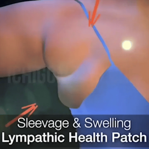 Lymphology – The #1 Patches for Reducing Armpit & Chin Puffiness